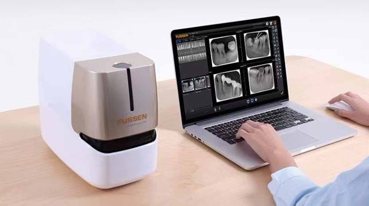 牙智宝-口内影像辅助诊断设备设计-1.jpg 牙智宝-口内影像辅助诊断设备设计-1.jpg